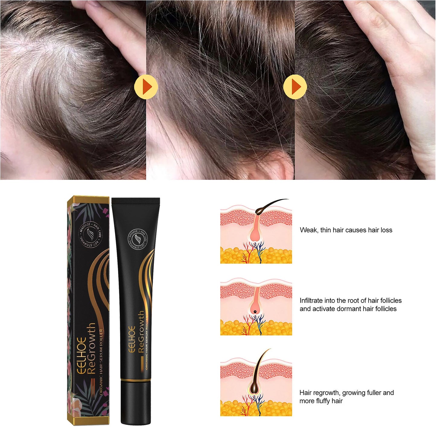 Eelhoe Regrowth Hair Serum Roller Massage For Scalp Nourishment