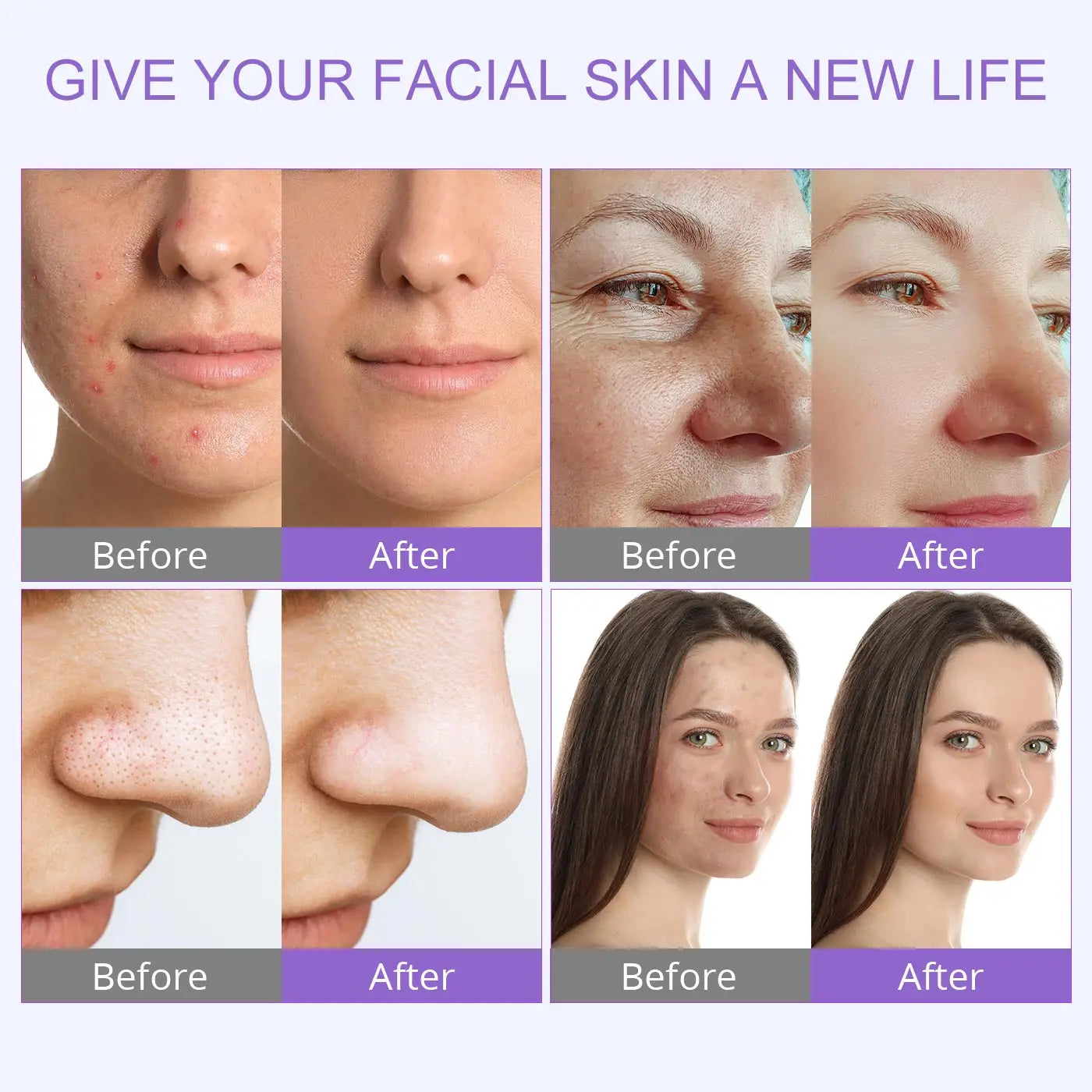UNOISETION Hydro Water Oxygen Jet Peel Facial Machine