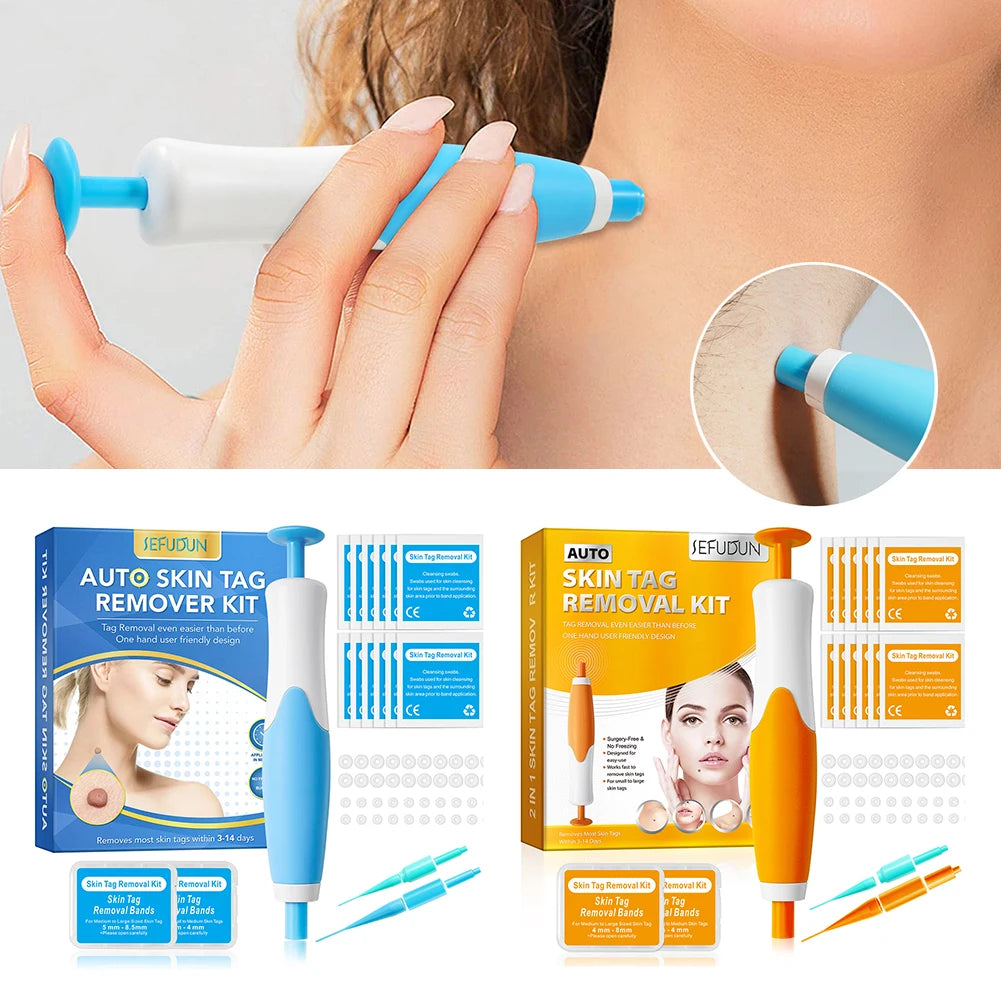 Rubber Ring Mole Removal Tool Kit Warts And Skin Tags