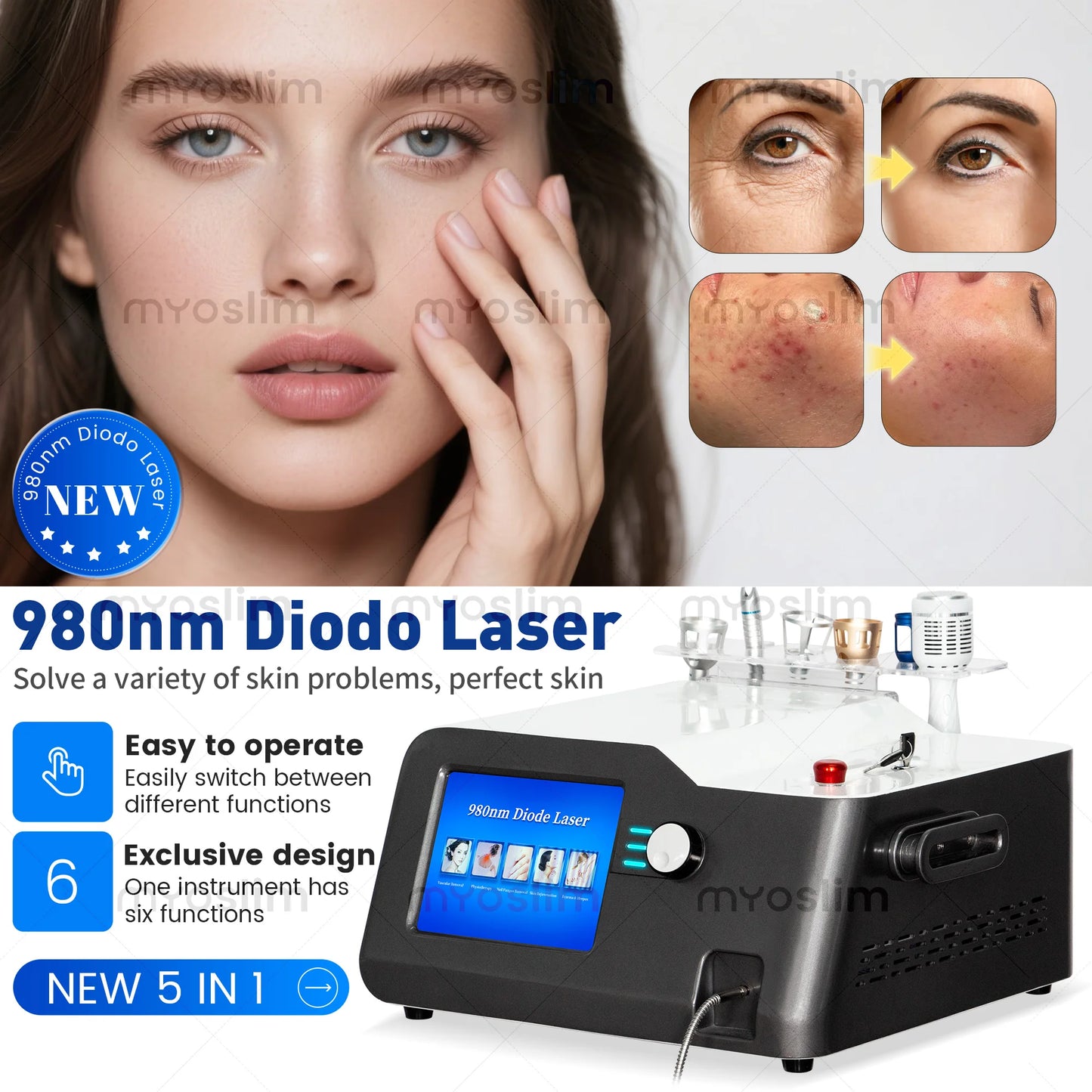 Five 980 Nanometer Diode Laser Vascular Vein Removal System