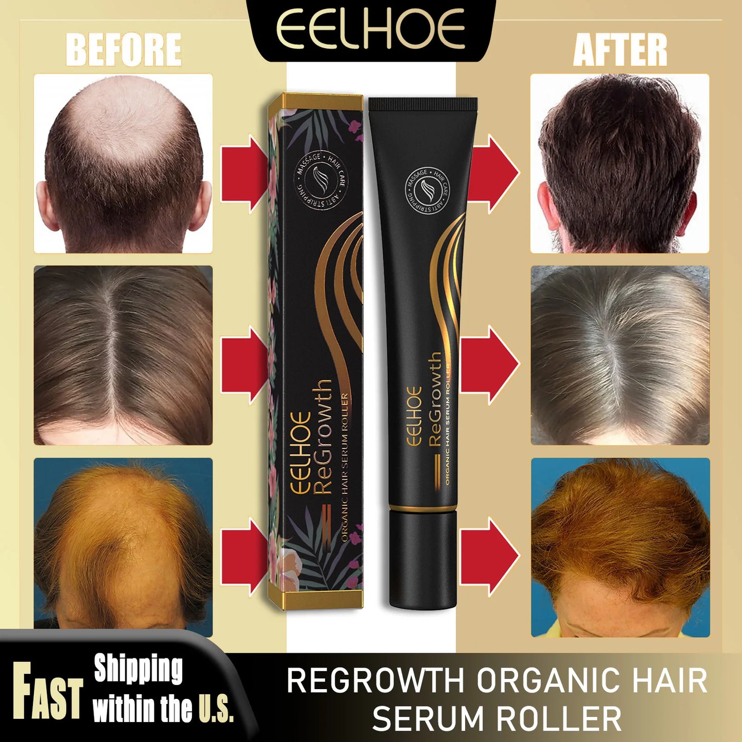 Eelhoe Regrowth Hair Serum Roller Massage For Scalp Nourishment